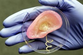 中国科学家率先用生物3D打印出真耳朵，菜花耳后天整形能变好看