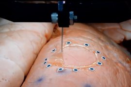 研究人员使用运动捕捉技术将3D打印传感器直接安装在器官上